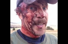 Muž natočil minuty po tom, co na něj zaútočil medvěd Grizzly